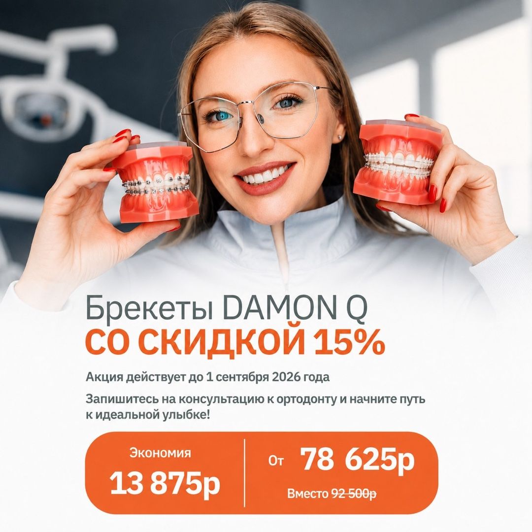 Брекеты Damon Q со скидкой 15%